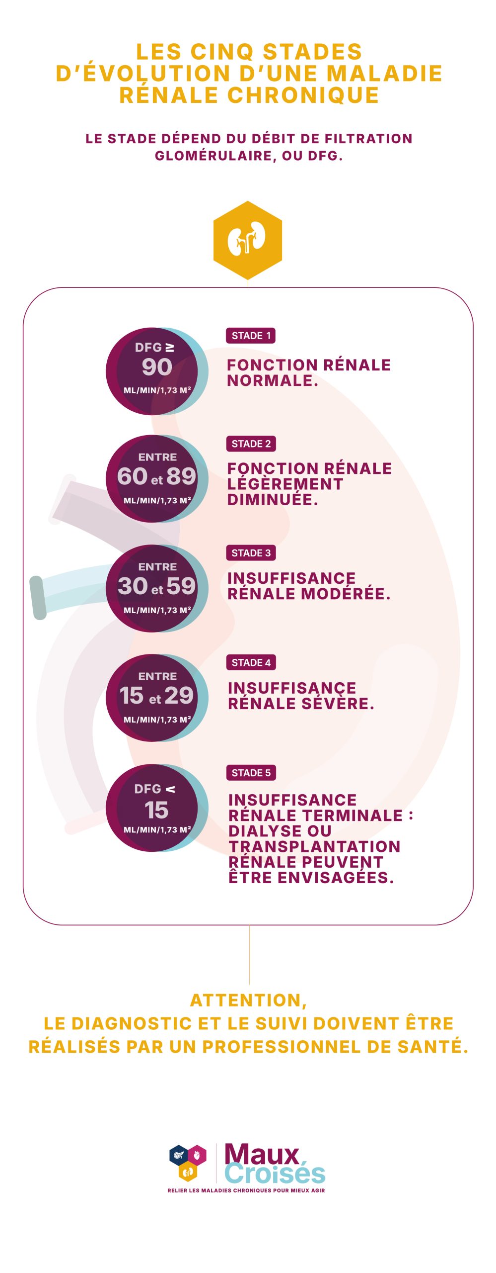 Infographie présentant les cinq stades d’évolution d’une maladie rénale chronique selon le débit de filtration glomérulaire, du stade 1 au stade 5